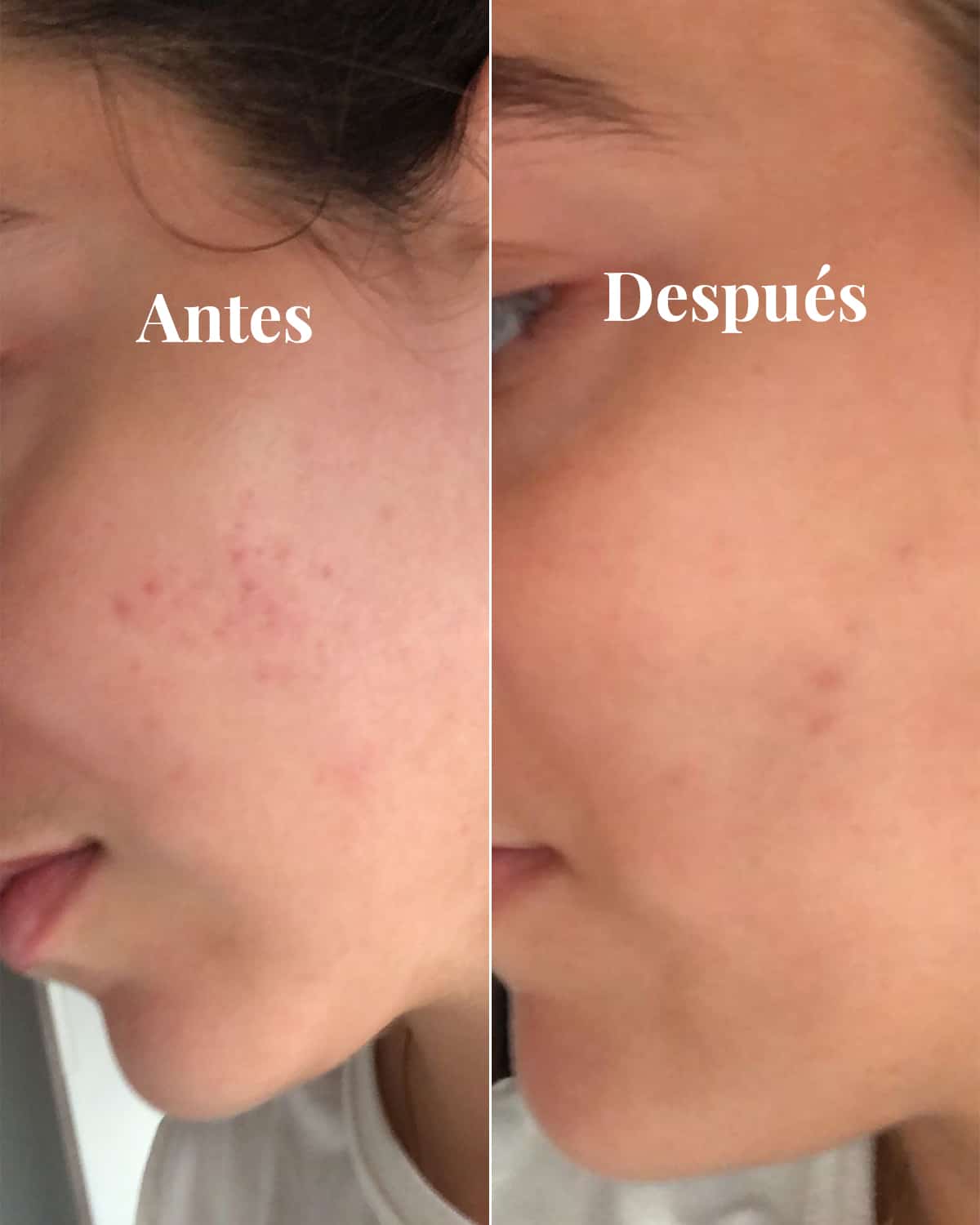 Sérum Anti-Nódoas Iluminador, 30 ml