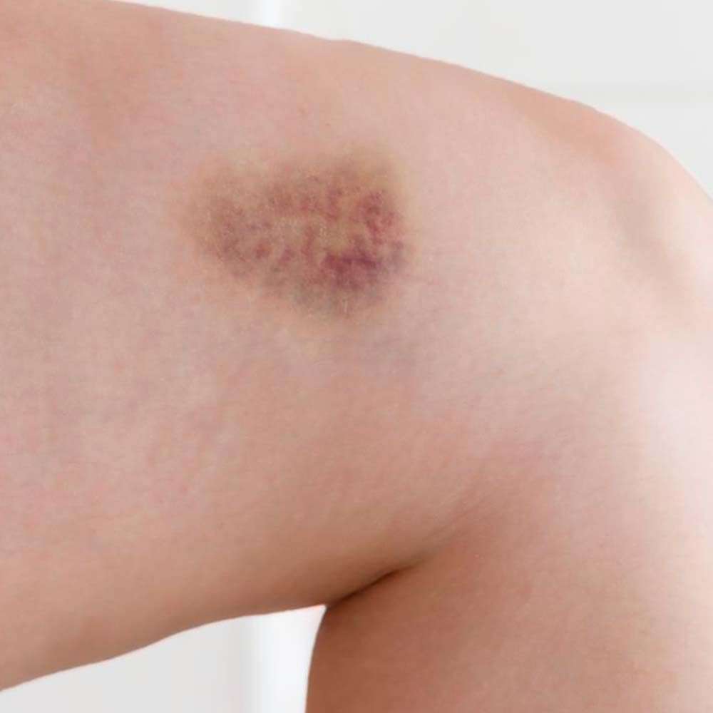 Jabón Natural De Árnica (90g) - Mejora Las Varices Y Hematomas - Alivia Las Piernas Cansadas - Cara Y Cuerpo_5