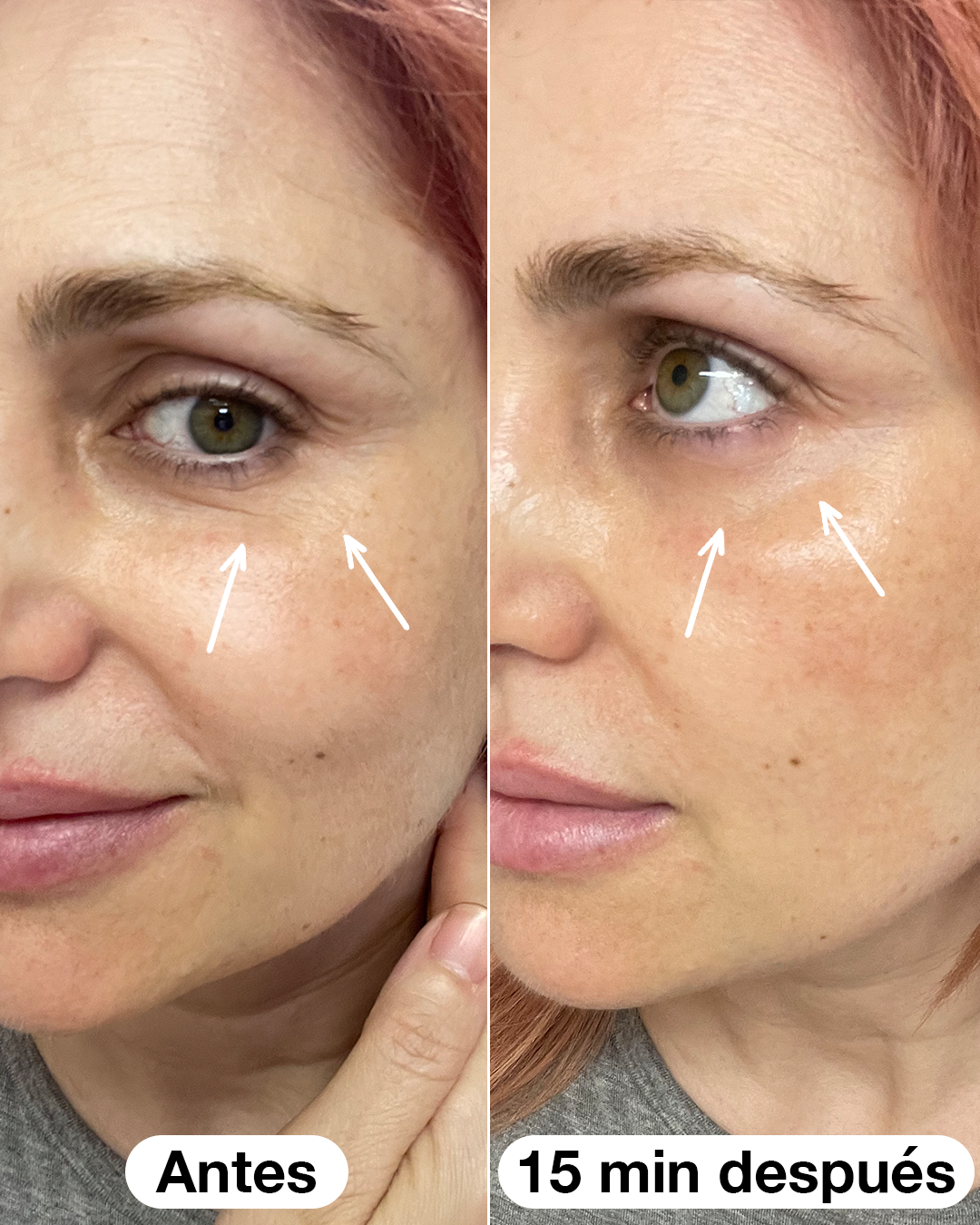 Salad Code Sérum Roll-on para os Olhos 10 ml