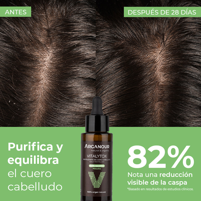 Vitalytox Arganour Revitalizante para Couro Cabeludo 50ml