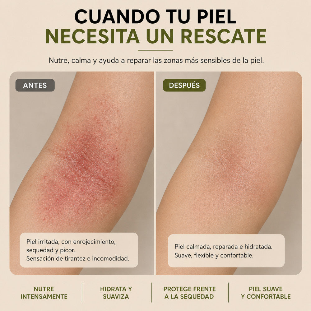 Bálsamo Maravilla Bio | Reparador Piel Dañada, Eccemas, Picor 50ml_5