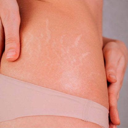 Pack 2 Jabón Natural De Aloe Vera - Indicado Para Todo Tipo De Piel - Hidrata, Aclara Manchas Y Reduce Estrías_4