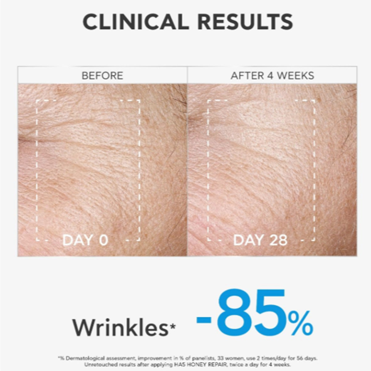 Sérum Reparador HA5 Miel Alisa y Rellena 30 ml