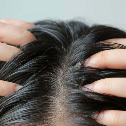 Champú Sólido Anticaspa - 100% Natural - Con Brea - Elimina Caspa Y Alivia Los Picores. Hecho En España - 1ud_2