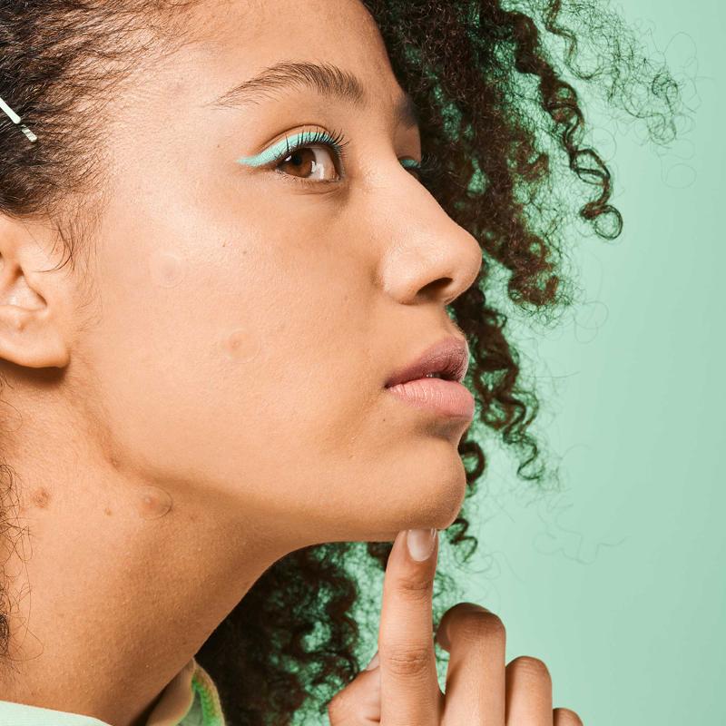 Iroha Nature SOS Pimple Patches com ácido salicílico, melaleuca e centelha asiática