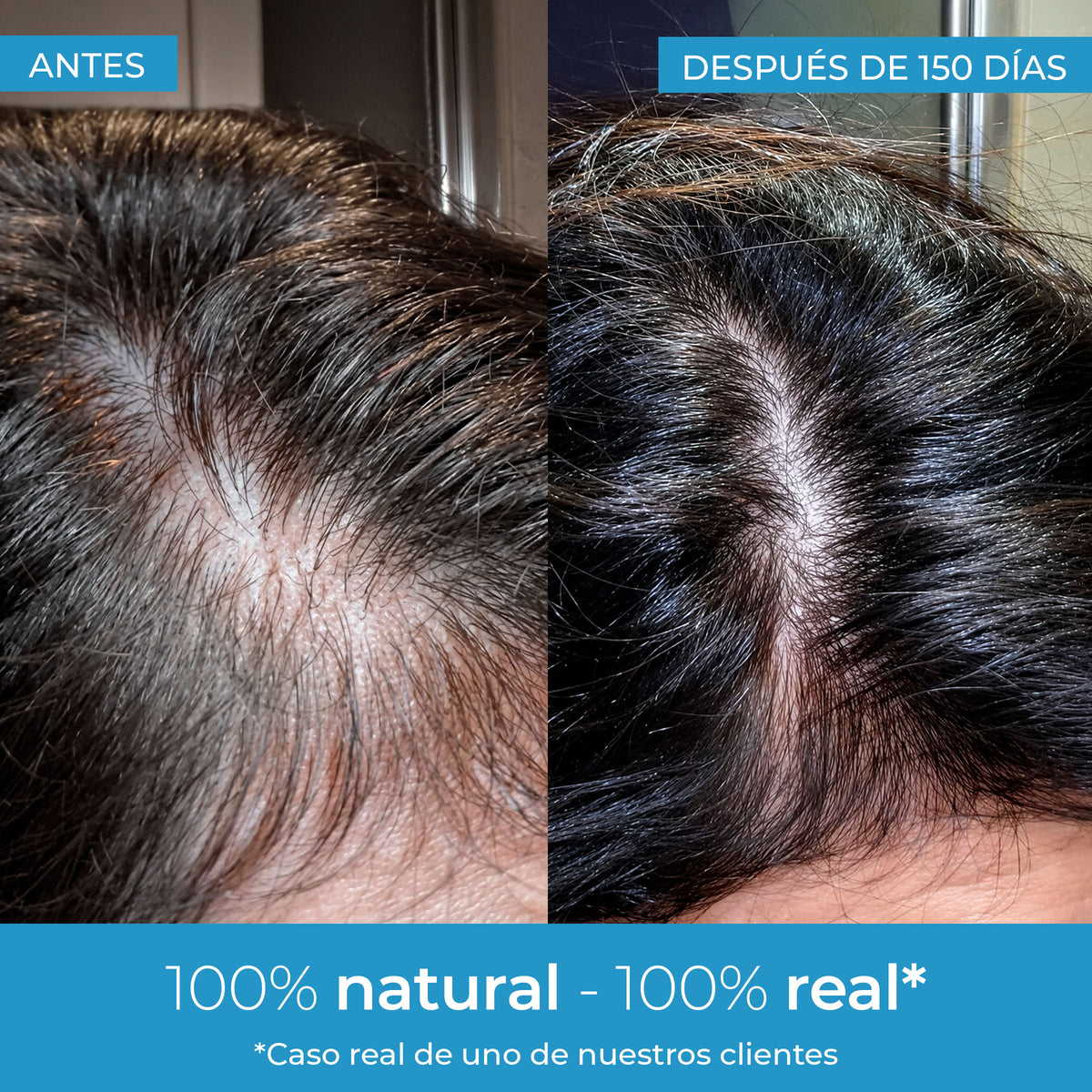 Loção para Crescimento Capilar Strength Arganour 50ml