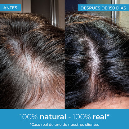 Loção para Crescimento Capilar Strength Arganour 50ml