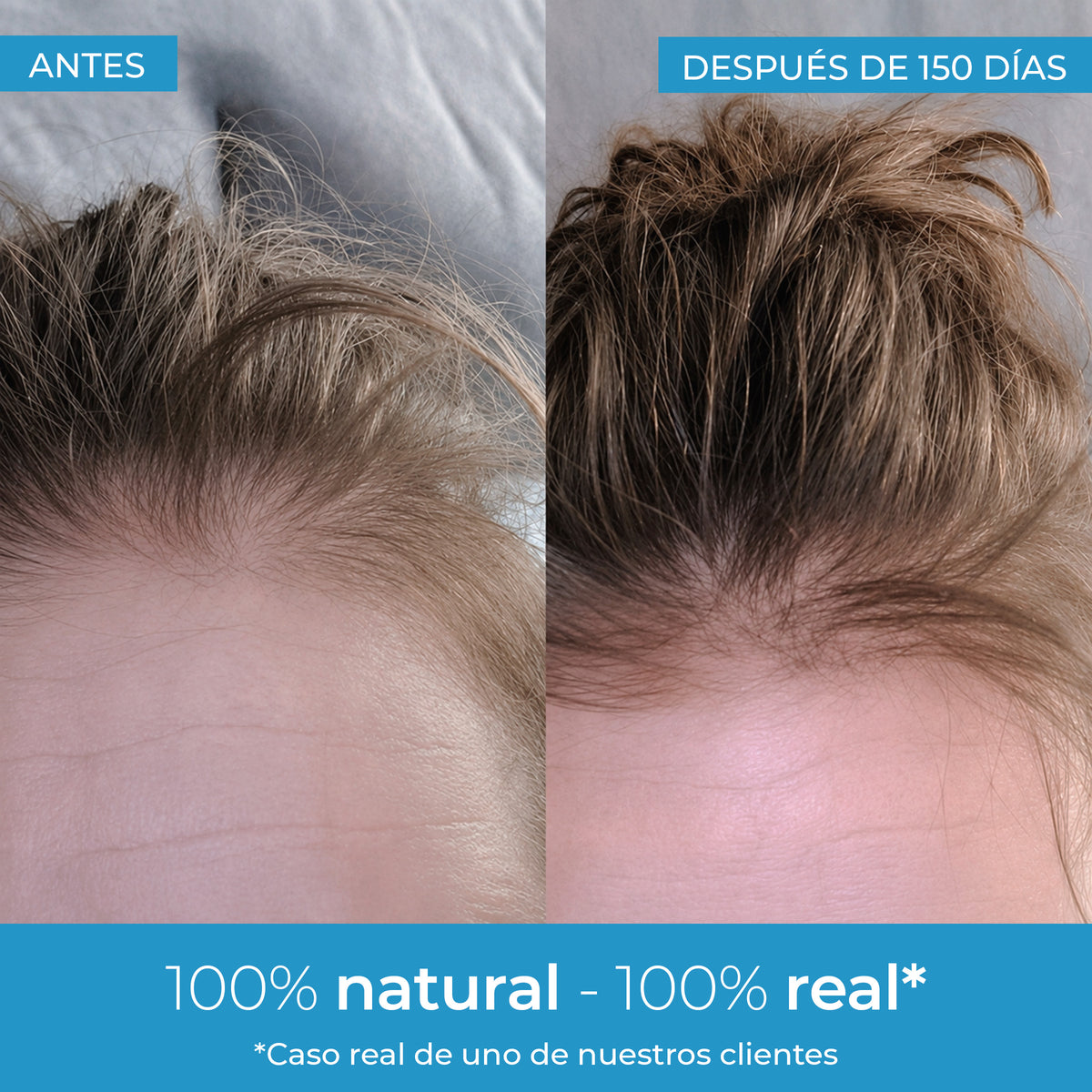 Loção para Crescimento Capilar Strength Arganour 50ml