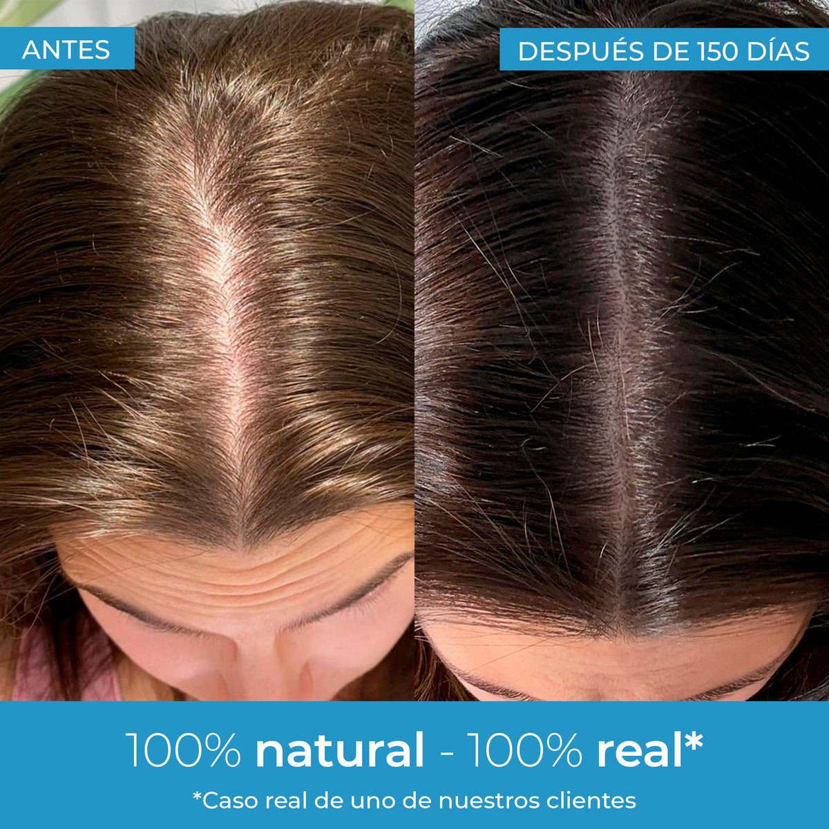 Loção para Crescimento Capilar Strength Arganour 50ml