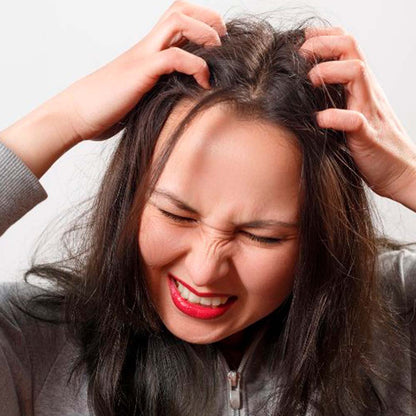 Champú Sólido Anticaspa - 100% Natural - Con Brea - Elimina Caspa Y Alivia Los Picores. Hecho En España - 1ud_3