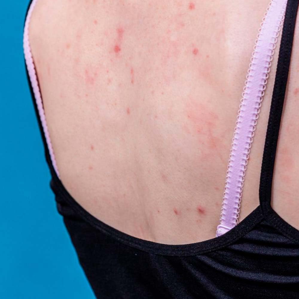 Pack 10 Jabón Natural Exfoliante Limón - Regula El Nivel De Grasa - Evita El Acné Y Aclara Sus Marcas - Exfoliante Suave_3