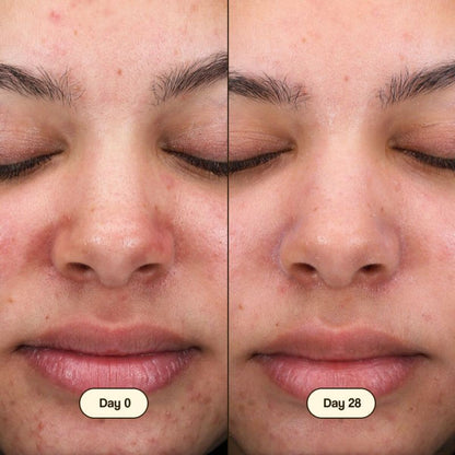 Limpador Facial Salicílico Fresly 100ml